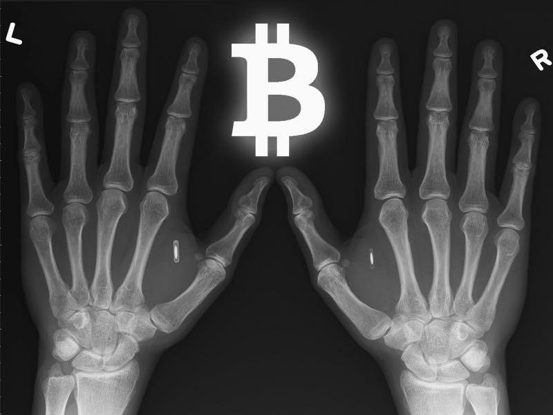 Bio-implantable bitcoin