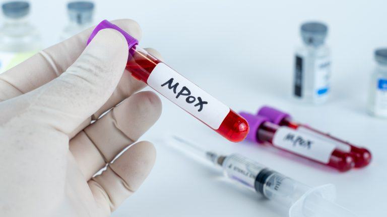 Pandemic Fears Ignite arsenic  Mpox Outbreak Leads to High-Stakes Betting connected  Polymarket